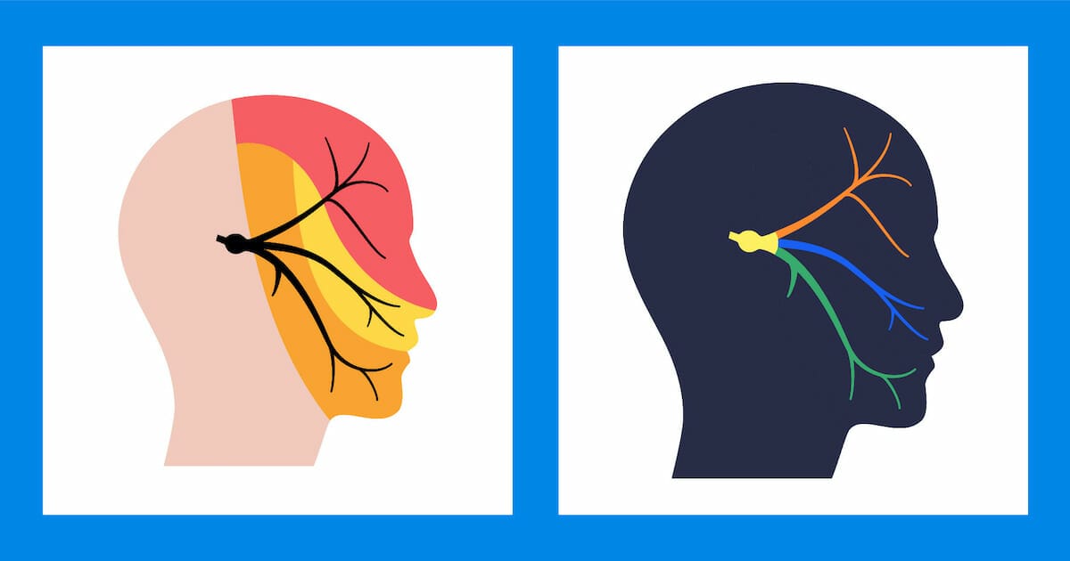 why-does-sumatriptan-only-work-for-headache-disorders-migraine